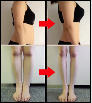 スマートレッグの効果-画像